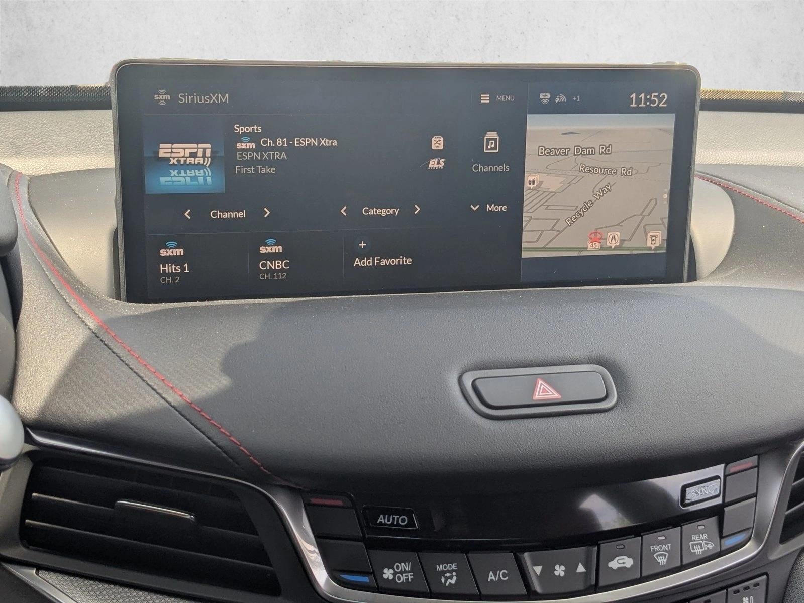 2025 Acura TLX SH-AWD w/A-Spec Package