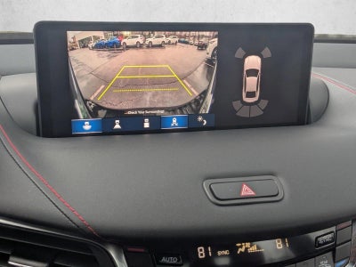 2025 Acura TLX SH-AWD w/A-Spec Package